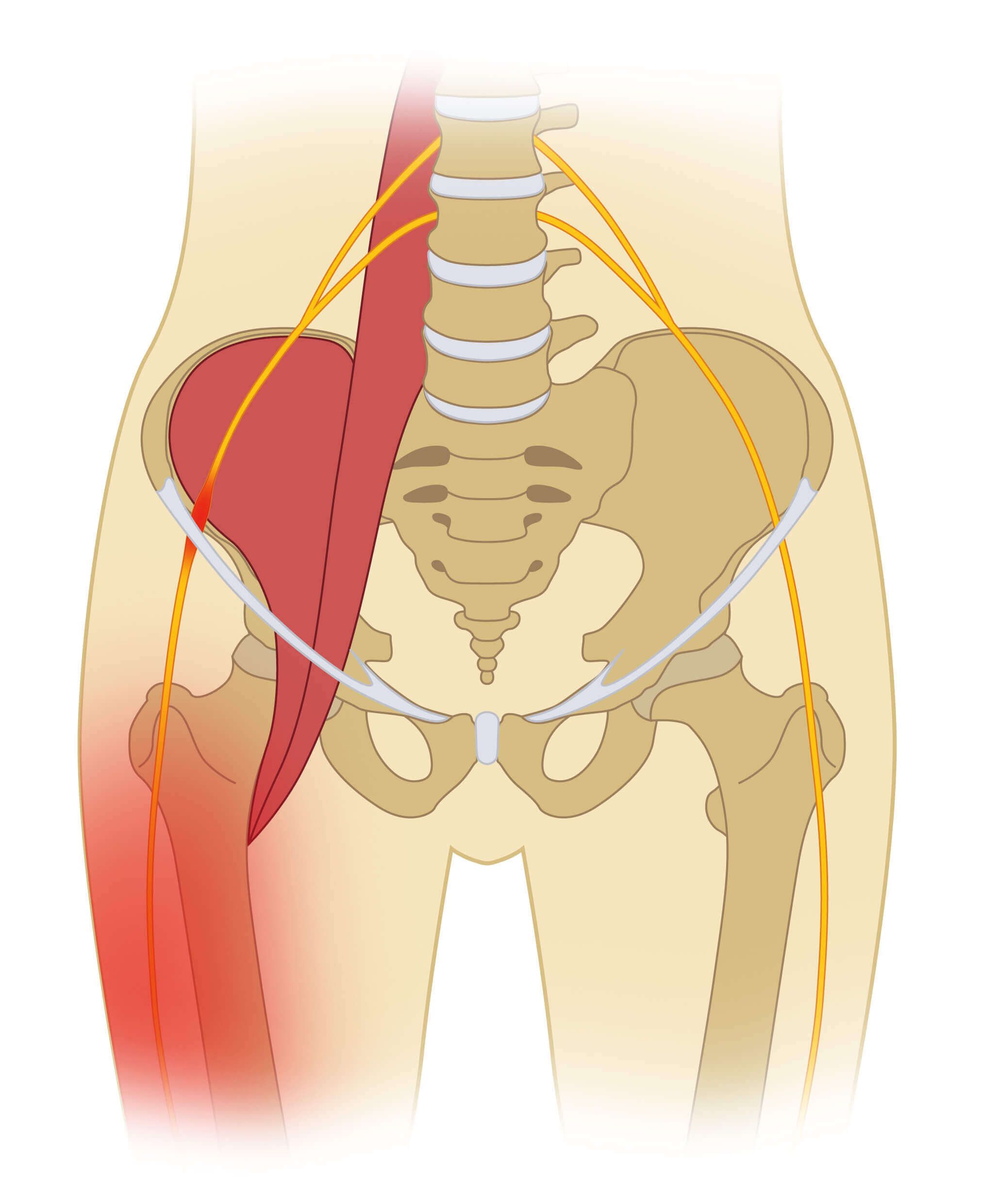 Puc Meralgia Paraesthetica Diagnose Und Therapie Mittels Hd Ultraschall